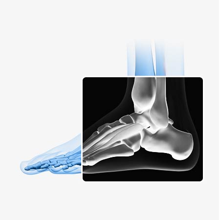 Foot X-Rays | Dr. Emmanuel Fuzaylov | Brooklyn and Jamaica
