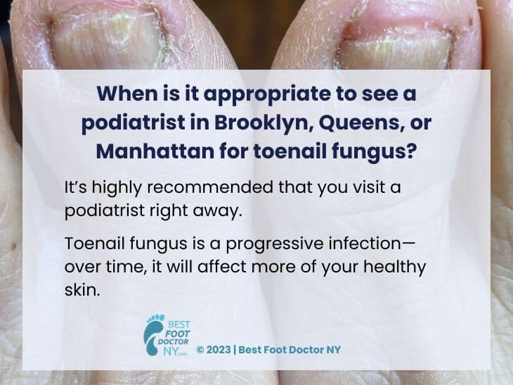 Callout 11: close-up of toes with fungal infection- visit a podiatrist in NYC area for proper diagnosis