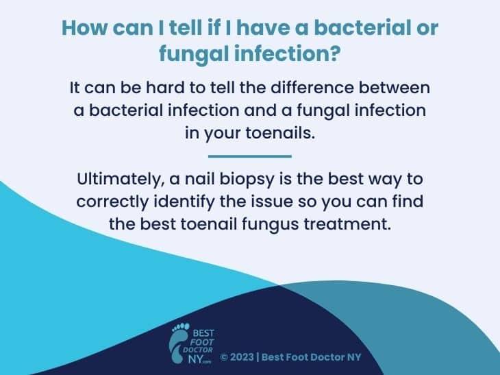 Callout 4: how can you tell if it's a bacterial or fungal infection? 2 facts listed