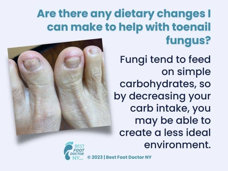 Callout 6: close-up of two feet- are there dietary changes that help with toenail fungus?- quote from text