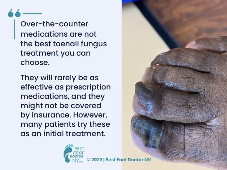 Callout 8: close-up of badly infected toenails- quote from text about OTC medications
