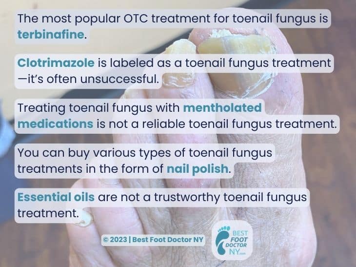 Callout 9: Terbinafine is most popular toenail fungus treatment OTC