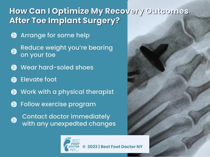 Callout 1:  After toe implant surgery x-ray- How can I optimize my recovery outcomes after toe implant surgery? - seven steps listed.