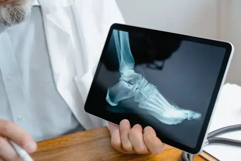 Doctor in a white coat holding a tablet displaying a side-view foot X-ray