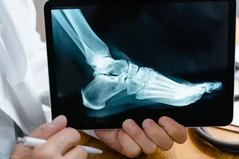 Doctor holding a tablet displaying a detailed side-view X-ray of the foot and ankle