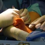 Surgeons operating on the sole of a foot with fine instruments under theatre lighting