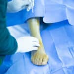 Surgeon injecting local anaesthetic into a foot draped for minimally invasive surgery